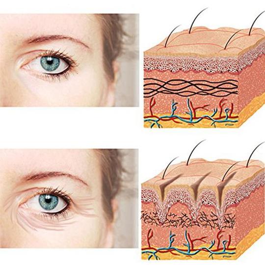 Reusable Silicone Anti-Wrinkle Patches — Eye & Forehead Wrinkle Treatment (3 Piece Set)