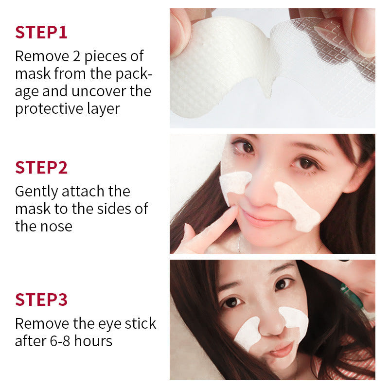 Overnight Nasolabial Fold & Smile Line Patches — 5 Pairs, Hydrogel Sleep Treatment