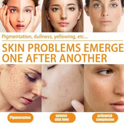 10% Vitamin C Brightening Serum — Glow, Even Tone & Hydrate Daily
